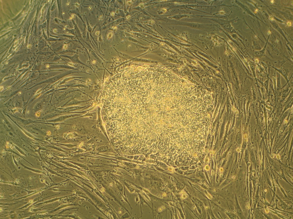 New chlamydia drug targets discovered using CRISPR and stem cells