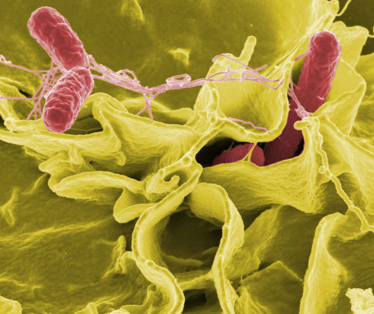 CBR Researchers Achieve near Atomic Resolution of Salmonella's Nano-Syringe