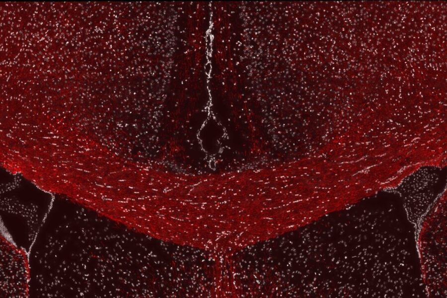 A fluorescent microscope image from Willis’ research showing healthy myelin in the adult mouse brain. The brain section has been labeled for a myelin protein (red) and cell nuclei (white).