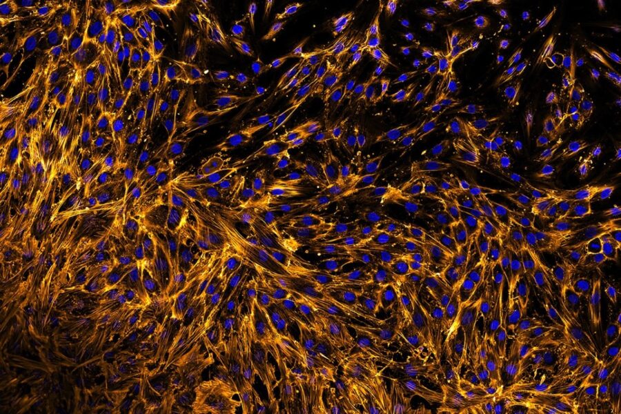 Human stem cells have the astounding potential to differentiate into various types of cells. Mesenchymal stem cells (MSCs), found in the bone marrow, are at the forefront of cutting-edge advances in medical applications such as skin wound healing and tissue regeneration. A key aspect of their regenerative potential is the ability of MSCs to migrate, which is controlled by a protein called actin. This image shows a culture of MSCs derived from human bone marrow, labelled with a fluorescent orange dye that binds to the actin, while a fluorescent blue stain (DAPI) lights up the cell nuclei. The orange dye helps us see the striking pointed shapes of the cells and the network of actin filament structures inside the cells that enables them to move to injured sites within the body. Insights into how these cells work could lead to breakthroughs in wound healing, regenerative medicine and more.