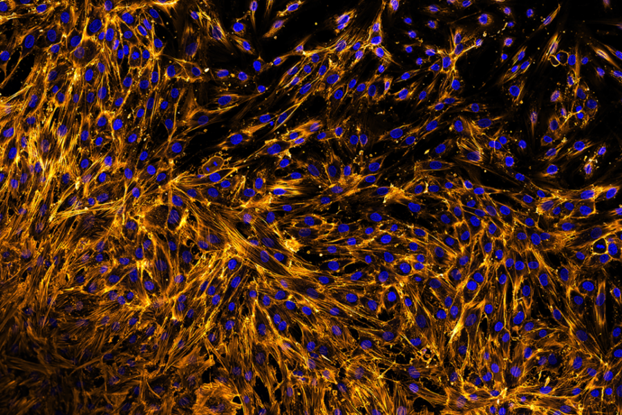 Angular diffusion by Aaron Dhanda